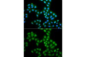 Immunofluorescence analysis of A549 cells using SAMHD1 antibody. (SAMHD1 抗体)