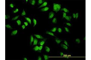 Image no. 1 for anti-Eukaryotic Translation Initiation Factor 2-alpha Kinase 2 (EIF2AK2) (AA 1-101) antibody (ABIN598900) (EIF2AK2 抗体  (AA 1-101))