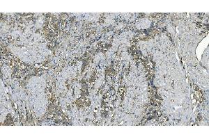 IHC analysis of EEF2/Elongation factor 2 using anti-EEF2/Elongation factor 2 antibody (ABIN7603142).