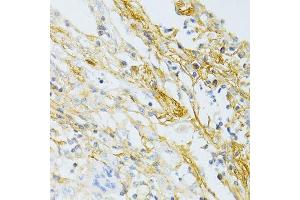Immunohistochemistry (Paraffin-embedded Sections) (IHC (p)) image for anti-Transforming Growth Factor, beta-Induced, 68kDa (TGFBI) (AA 481-683) antibody (ABIN3023373)