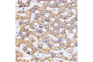 Immunohistochemistry of paraffin-embedded Human liver using MITD1 Rabbit pAb (ABIN7268548) at dilution of 1:100 (40x lens). (MITD1 抗体)