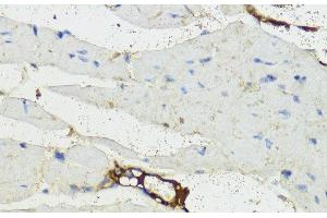 Immunohistochemistry (Paraffin-embedded Sections) (IHC (p)) image for anti-Complement Factor B (CFB) antibody (ABIN7259542)