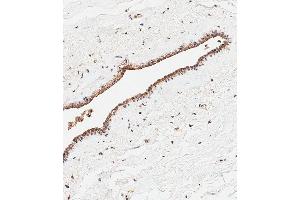 Immunohistochemistry (Paraffin-embedded Sections) (IHC (p)) image for anti-Choline/ethanolamine phosphotransferase 1 (CEPT1) (AA 29-57), (N-Term) antibody (ABIN654330)