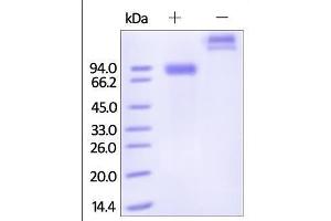 SDS-PAGE (SDS) image for Sialic Acid Binding Ig-Like Lectin 6 (SIGLEC6) (AA 16-320) protein (Fc Tag) (ABIN2181763)