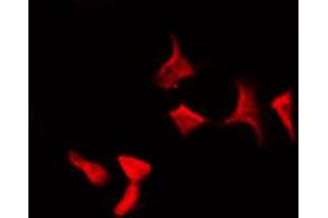 ABIN6267589 staining HepG2 by IF/ICC. (RELB 抗体  (pSer573))