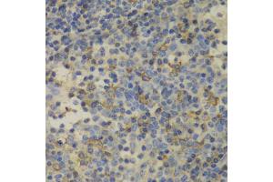 Immunohistochemistry of paraffin-embedded human amygdalitis using FTL antibody (ABIN5970889) at dilution of 1/100 (40x lens). (FTL 抗体)