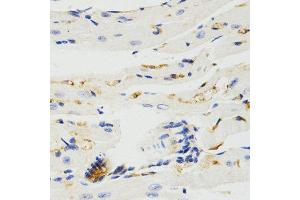 Immunohistochemistry (IHC) image for anti-TNF Receptor-Associated Factor 7 (TRAF7) antibody (ABIN3023478) (TRAF7 抗体)