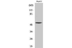 Western Blotting (WB) image for anti-CaM Kinase-Like Vesicle-Associated (CAMKV) (Internal Region) antibody (ABIN3174158) (CAMKV 抗体  (Internal Region))