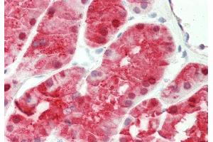 Rabbit Anti-KHK antibody  Formalin Fixed Paraffin Embedded Tissue: Human Kidney Primary antibody Concentration: 1:100 Secondary Antibody: Donkey anti-Rabbit-Cy3 Secondary Antibody Concentration: 1:200 Magnification: 20x Exposure Time: 0. (Ketohexokinase 抗体  (N-Term))