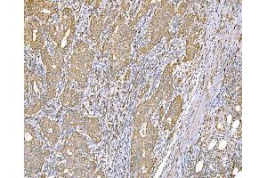 IHC analysis of SND1 using anti-SND1 antibody (ABIN7600525). (SND1 抗体  (AA 20-204))