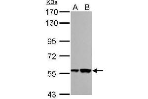 WB Image RBMY1A1 antibody detects RBMY1A1 protein by Western blot analysis. (RBMY1A1 抗体)