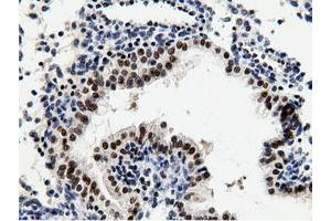 Image no. 2 for anti-5'-Nucleotidase Domain Containing 1 (NT5DC1) antibody (ABIN1499838) (NT5DC1 抗体)