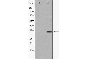 Western blot analysis of Hela whole cell lysates, using CDK6  Antibody. (CDK6 抗体  (N-Term))