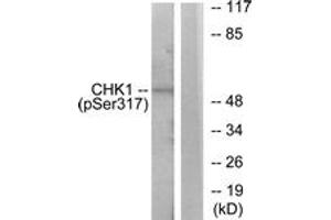 Western blot analysis of extracts from MCF7 cells, using Chk1 (Phospho-Ser317) Antibody. (CHEK1 抗体  (pSer317))