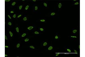 Immunofluorescence of monoclonal antibody to ALYREF on HeLa cell.