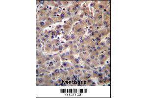 GUSB Antibody immunohistochemistry analysis in formalin fixed and paraffin embedded human liver tissue followed by peroxidase conjugation of the secondary antibody and DAB staining. (Glucuronidase beta 抗体  (C-Term))