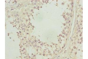 Immunohistochemistry of paraffin-embedded human testis tissue using ABIN7146719 at dilution of 1:100 (CA3 抗体  (AA 2-260))