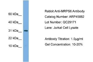 WB Suggested Anti-MRPS6  Antibody Titration: 0. (MRPS6 抗体  (C-Term))