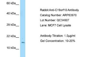 Western Blotting (WB) image for anti-Chromosome 19 Open Reading Frame 10 (C19orf10) (N-Term) antibody (ABIN2789685) (C19orf10 抗体  (N-Term))