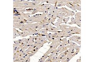 Immunohistochemistry of paraffin embedded rat heart using ANXA3 (ABIN7073065) at dilution of 1: 300 (400x lens) (Annexin A3 抗体)