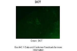 Sample Type :  Zebrafish embryo section  Primary Antibody Dilution :  1:50  Secondary Antibody :  Anti-rabbit-Alexa Fluor 488  Secondary Antibody Dilution :  1:500  Color/Signal Descriptions :  Green: DCT  Gene Name :  Dct  Submitted by :  Anonymous (DCT 抗体  (Middle Region))