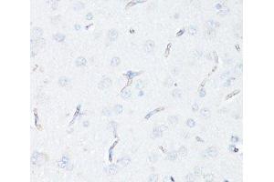 Immunohistochemistry of paraffin-embedded Rat brain endothelial cells using P Glycoprotein Polyclonal Antibody at dilution of 1:100 (40x lens). (P-Glycoprotein 抗体)