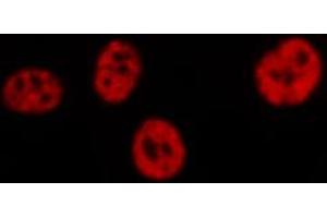ABIN6267309 staining HeLa by IF/ICC. (C-JUN 抗体  (pSer73))