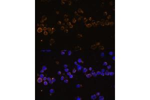 Immunofluorescence analysis of Jurkat cells using KLRC4 Polyclonal Antibody (ABIN7268115) at dilution of 1:100 (40x lens). (KLRC4 抗体  (AA 1-55))