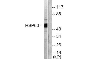 Western blot analysis of extracts from COLO205 cells, using HSP60 antibody (#C0233). (HSPD1 抗体)