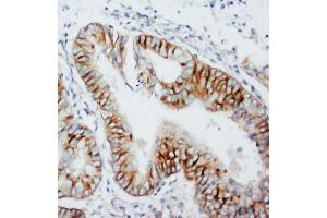 Immunohistochemistry (IHC) image for anti-Chemokine (C-C Motif) Receptor 5 (CCR5) (AA 19-34), (N-Term) antibody (ABIN3044318)