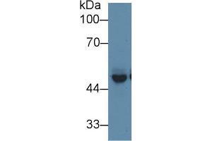 Western blot analysis of Mouse Cerebrum lysate, using Mouse PICK1 Antibody (1 µg/ml) and HRP-conjugated Goat Anti-Rabbit antibody ( (PICK1 抗体  (AA 24-229))
