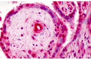 Human Placenta: Formalin-Fixed, Paraffin-Embedded (FFPE) (RBX1 抗体  (C-Term))
