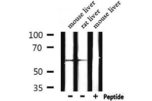 Western blot analysis of extracts from mouse liver,rat liver, using Catalase Antibody.