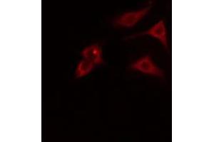 ABIN6274793 staining HT29 cells by IF/ICC. (ABHD8 抗体  (Internal Region))
