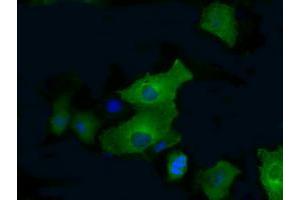 Anti-PFKFB4 mouse monoclonal antibody (ABIN2453452) immunofluorescent staining of COS7 cells transiently transfected by pCMV6-ENTRY PFKFB4 (RC201573). (PFKFB4 抗体)