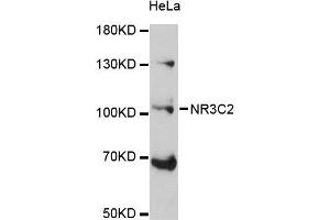 Western blot analysis of extracts of HeLa cells, using NR3C2 antibody (ABIN5971700) at 1:3000 dilution. (NR3C2 抗体)