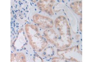 Used in DAB staining on fromalin fixed paraffin- embedded Kidney tissue (PTPN7 抗体  (AA 52-314))