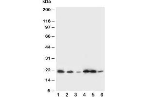 Western blot testing of SSR3 antibody and Lane 1:  rat liver;  2: rat spleen; and human samples 3: A431;  4: HeLa;  5: U87;  6: SMMC-7721 cell lysate. (SSR3 抗体  (AA 8-23))
