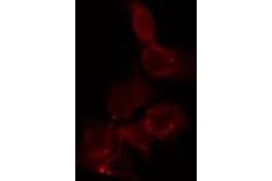 ABIN6267607 staining HepG2 by IF/ICC. (FAK 抗体  (pTyr397))