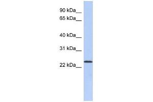 ULBP1 antibody used at 1 ug/ml to detect target protein. (ULBP1 抗体  (N-Term))