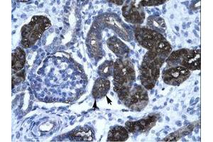 Image no. 1 for anti-GC-Rich Promoter Binding Protein 1 (GPBP1) (AA 67-116) antibody (ABIN6736275) (GC-Rich Promoter Binding Protein 1 (GPBP1) (AA 67-116) 抗体)