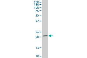DHFR monoclonal antibody (M01), clone 2B10. (Dihydrofolate Reductase 抗体  (AA 88-187))