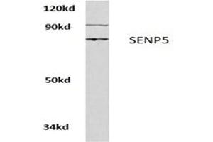 Image no. 1 for anti-SUMO1/sentrin Specific Peptidase 5 (SENP5) antibody (ABIN271958) (SENP5 抗体)