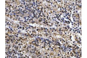 IHC analysis of CEP250 using anti-CEP250 antibody (ABIN7602053). (CEP250 抗体  (AA 563-853))