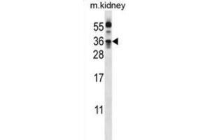 Western Blotting (WB) image for anti-Kallikrein 8 (KLK8) antibody (ABIN3002619)