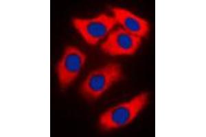 Immunofluorescent analysis of NEURL1 staining in MCF7 cells. (NEURL 抗体  (Center))