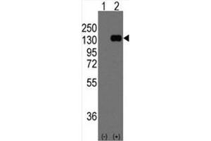 Image no. 2 for anti-Cadherin 1, Type 1, E-Cadherin (Epithelial) (CDH1) (C-Term) antibody (ABIN356995)