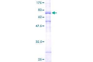 HDAC8 Protein (AA 1-377) (GST tag)