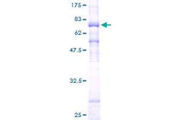 HDAC8 Protein (AA 1-377) (GST tag)
