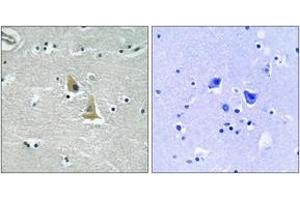 Immunohistochemistry analysis of paraffin-embedded human brain tissue, using p47 phox (Ab-345) Antibody. (NCF1 抗体  (AA 311-360))